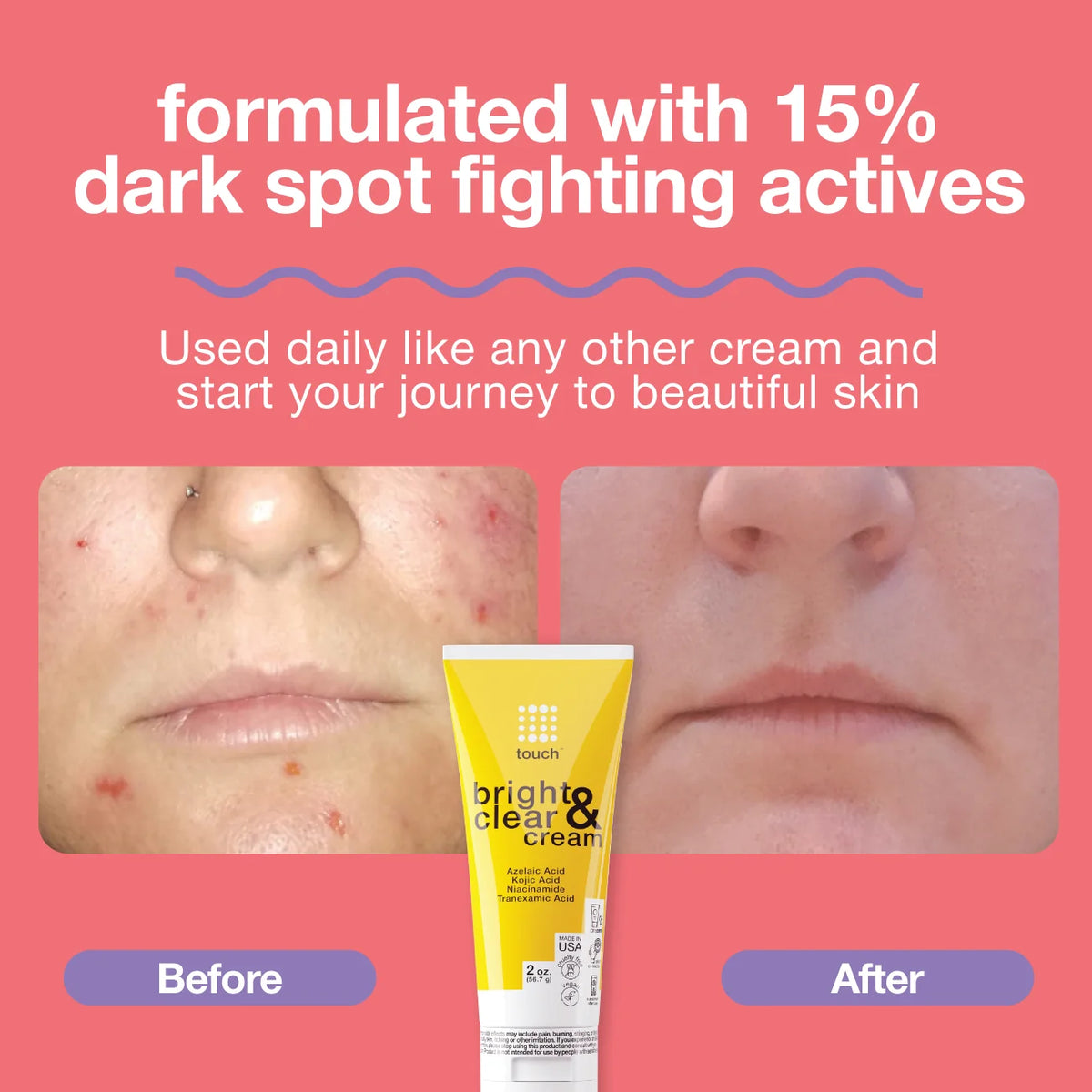 Bright & Clear Cream
