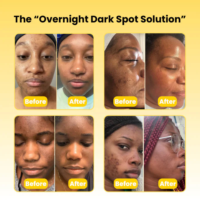 Medicube Kojic Acid Turmeric Overnight Mask